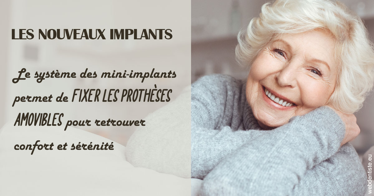 https://www.cbsorthodontie.lu/Les nouveaux implants 1