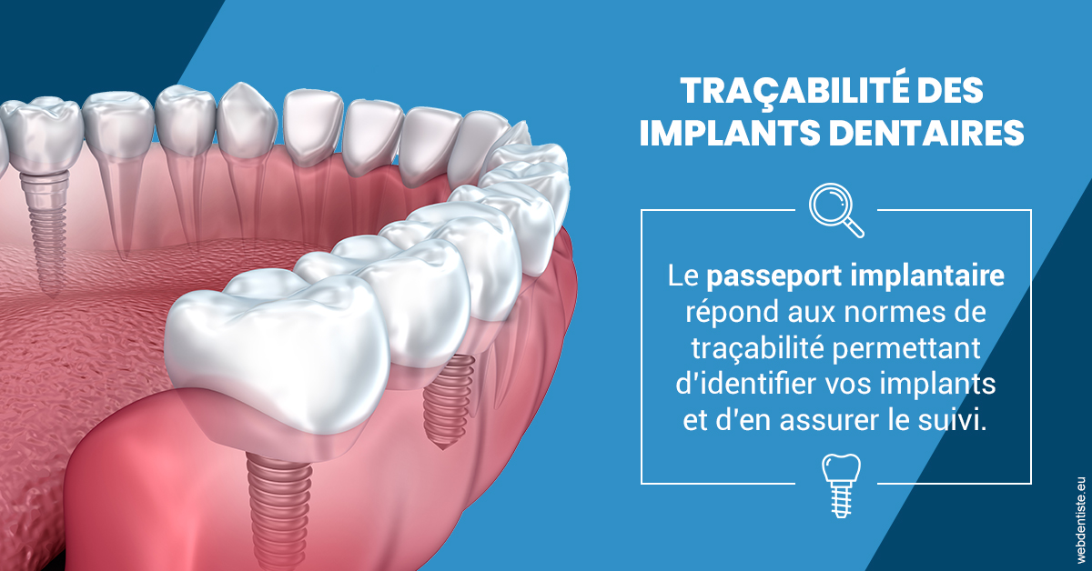 https://www.cbsorthodontie.lu/T2 2023 - Traçabilité des implants 1