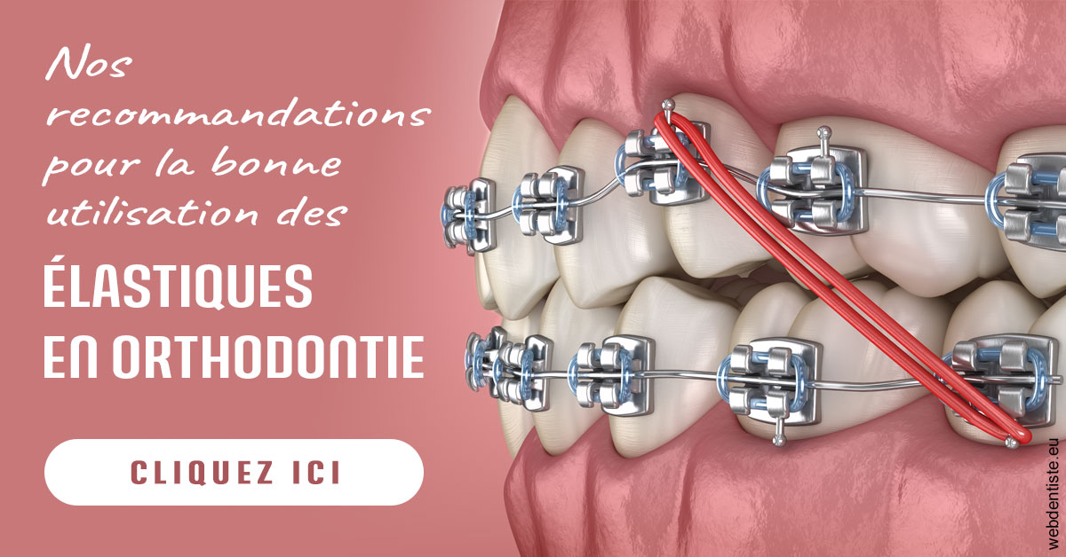 https://www.cbsorthodontie.lu/Elastiques orthodontie 2